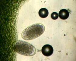 Strongyle eggs (100x magnification)